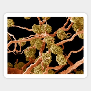 Kidney glomeruli, SEM (P550/0206) Sticker